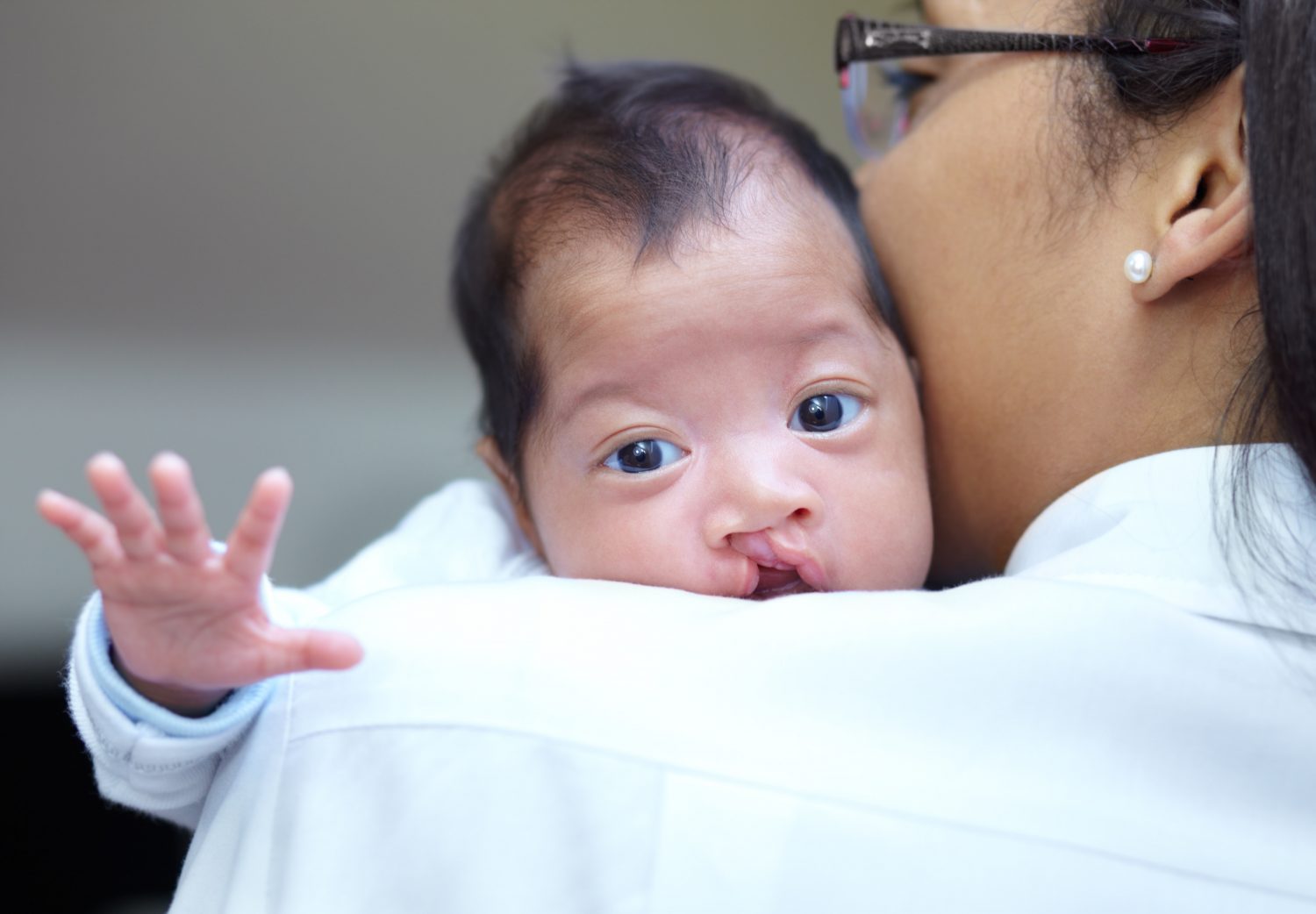 CLEFT-Q | Q-Portfolio - MEASURING WHAT MATTERS TO PATIENTS